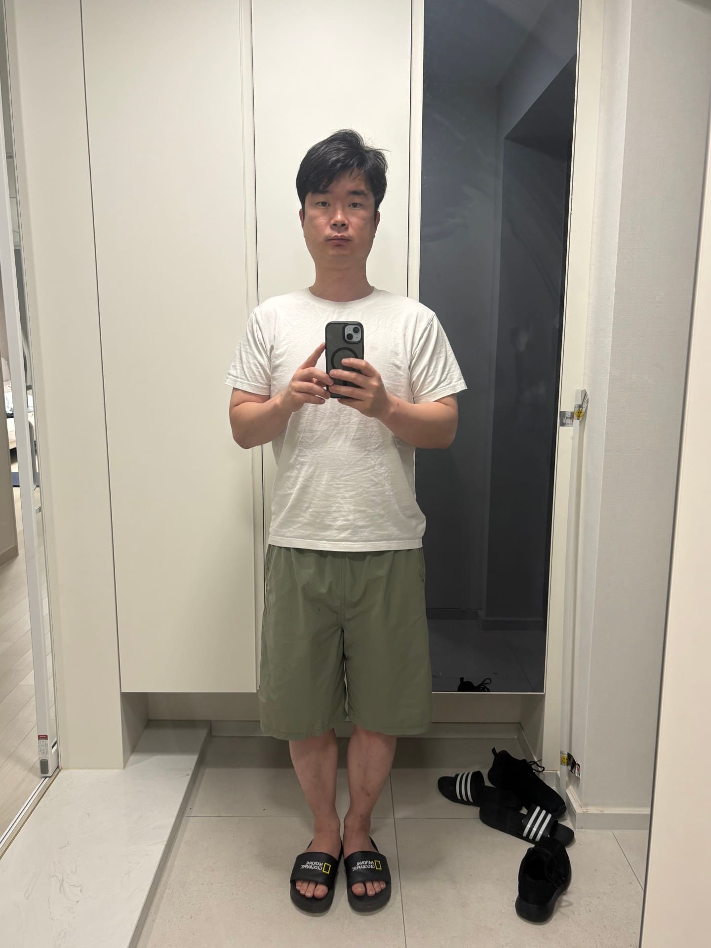 권0수 고객님 비포 사진
