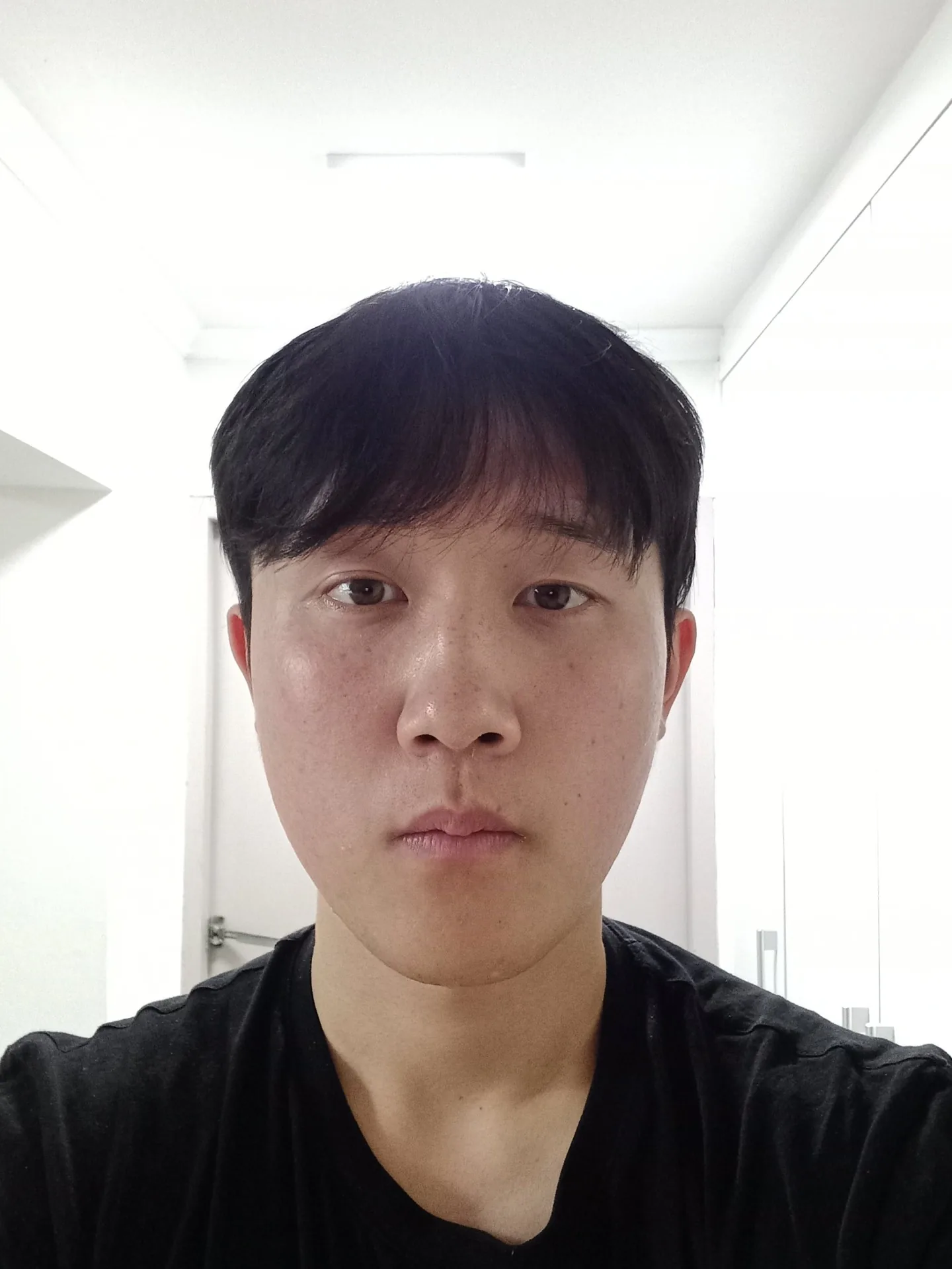 비포 이미지 05